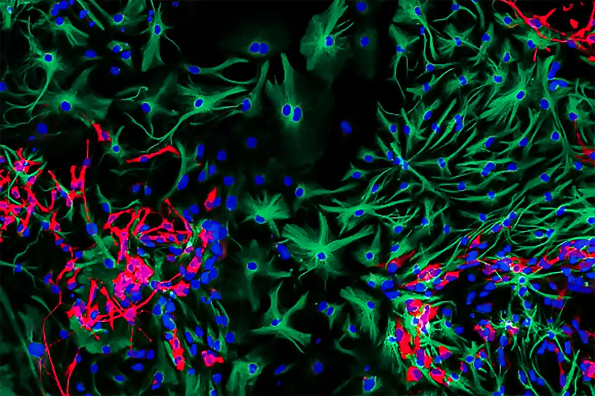 Cancer,Treatment,The death of Death